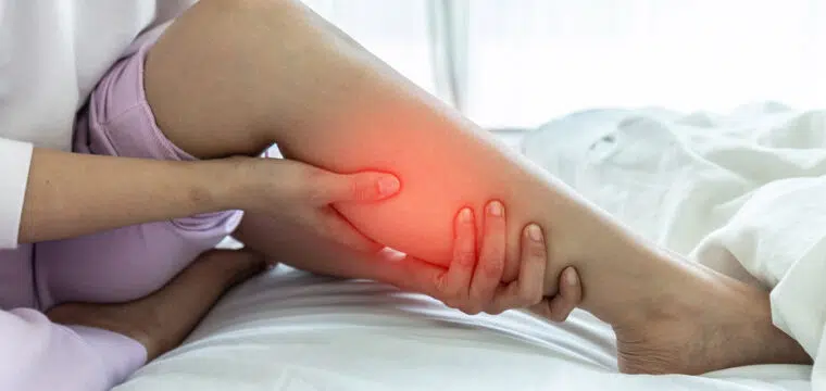 endovenous ablation