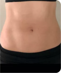 emsculpt